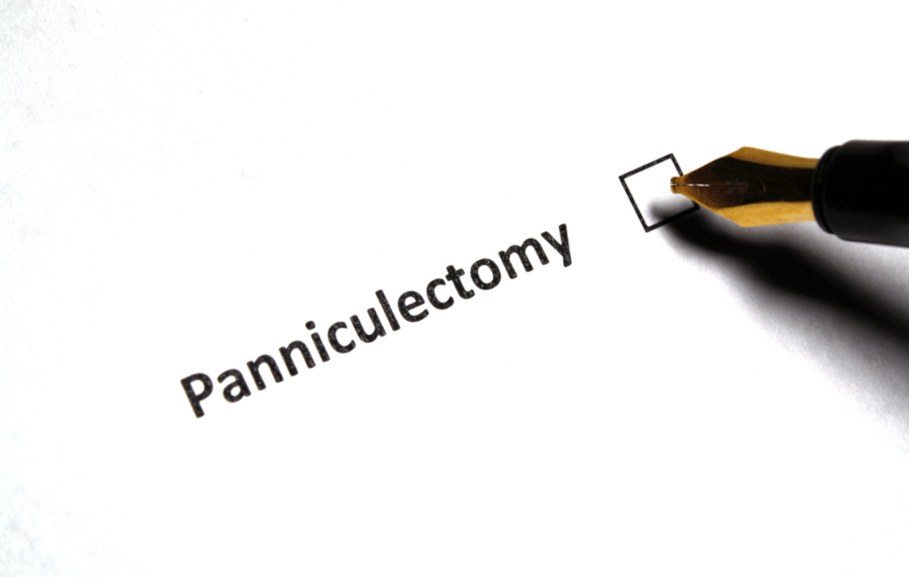 Panniculectomy