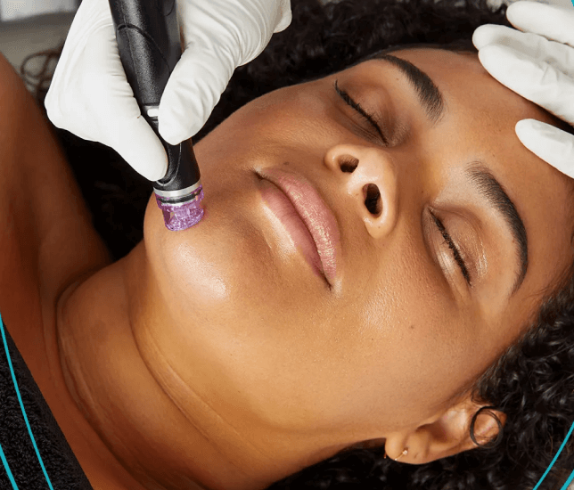 hydrfacial-treatment