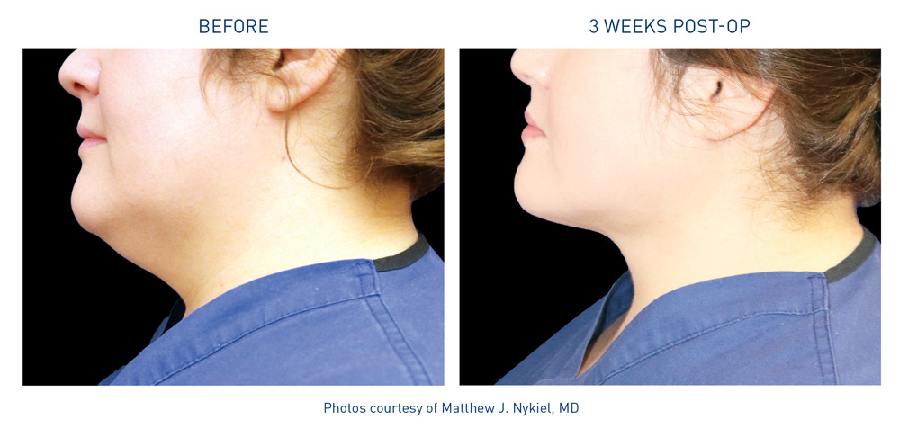 mm0285.01_neck_9_nykiel_72dpi