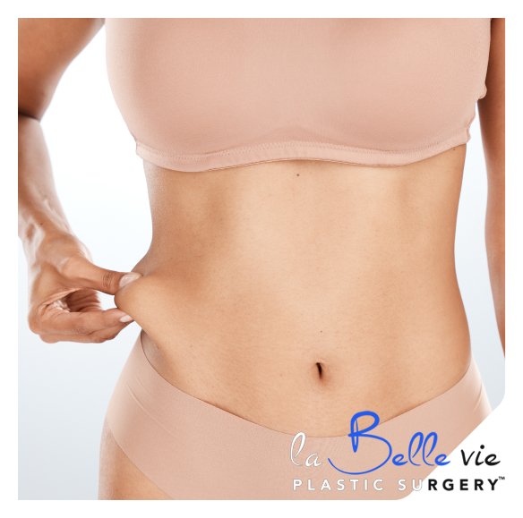 Benefits of belt lipectomy